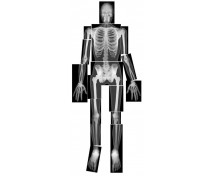Emberi test röntgenlapja